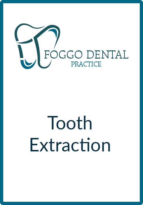 Tooth Extraction